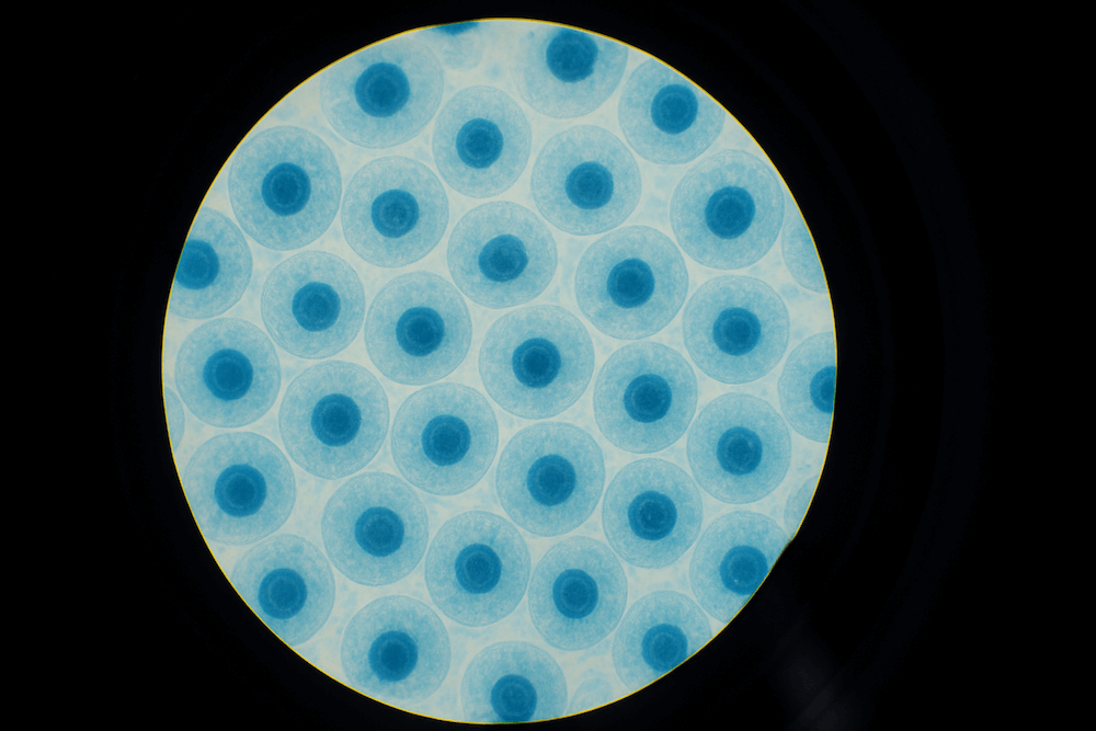 metaplasia jelentése